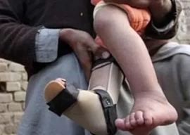 polio tally hits 27 with hyderabad case polio tally hits 27 with hyderabad case