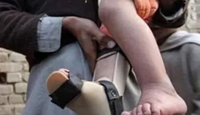 first wild polio case of 2026 confirmed in sindh