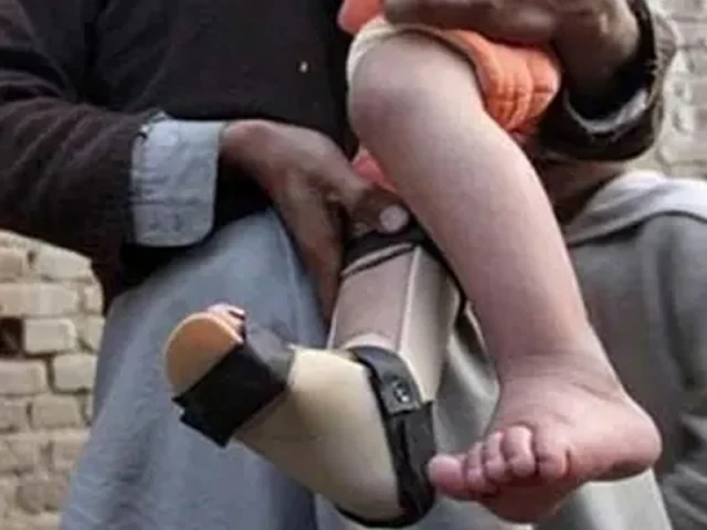 polio tally hits 27 with hyderabad case