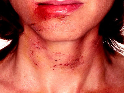 her husband beat her and other women told her it s probably her fault her husband beat her and other women told her it s probably her fault