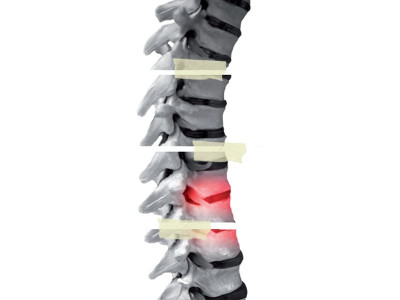 hayatabad paraplegic centre some play with their lives others put them back together