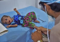 malnutrition costs country rs4 76tr annually