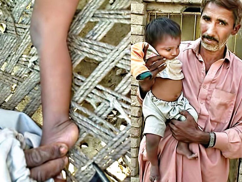 unhealthy concerns vehari reports 4th polio case of 2011