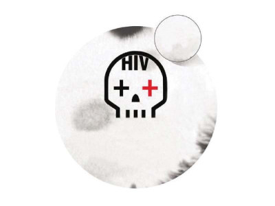 around 160 hiv patients miss doctor s appointments