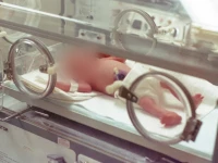 nurse blamed for infant s thumb loss