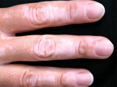 health tips not just skin deep health tips not just skin deep