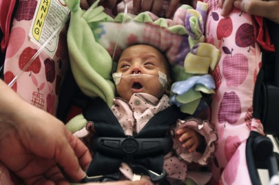 third smallest baby ever leaves us hospital third smallest baby ever leaves us hospital