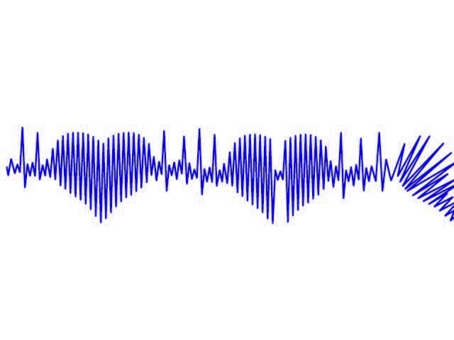 heart attack with no chest pain more likely in women heart attack with no chest pain more likely in women