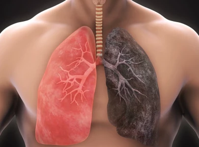 air pollution causing respiratory problems