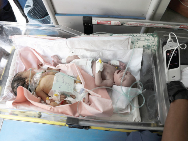 palestinian premature babies are evacuated from al aqsa hospital to khan younis nasser hospital following israeli evacuation orders photo reuters