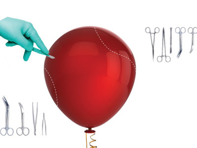 the skinny on weight loss surgery the skinny on weight loss surgery