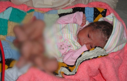 wonders of nature baby born with extra limbs wonders of nature baby born with extra limbs