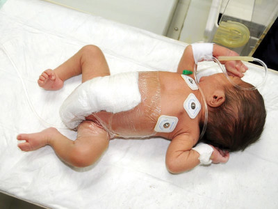 homecoming no longer the six legged baby parents name child mohammad ahmed