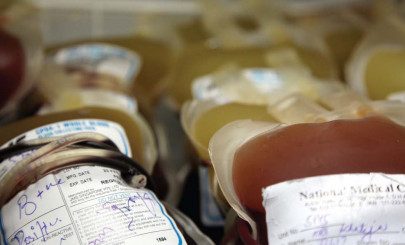 blood transfusion voluntary donations and a blood database needed blood transfusion voluntary donations and a blood database needed