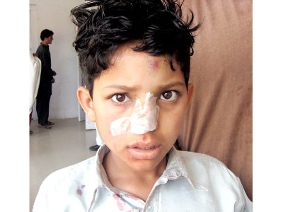 corporal punishment beaten by teacher second grader seeks justice