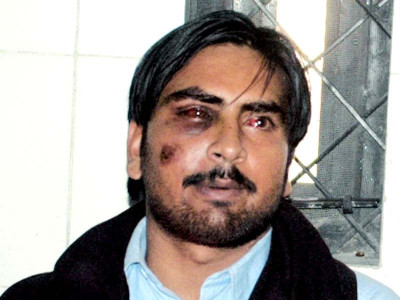 torture wardens suspended for beating prisoner