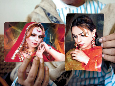 acid attack survivor determined to rebuild life acid attack survivor determined to rebuild life