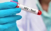 hiv screening to be made mandatory