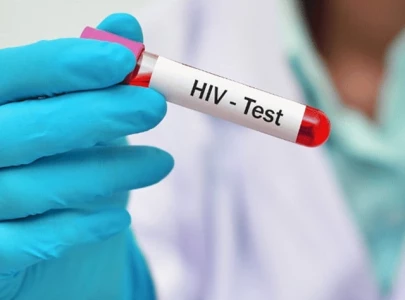hiv screening to be made mandatory