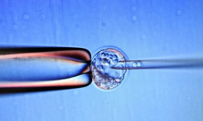 girl gets vein grown from her own cells in lab report