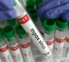 another mpox case reported in city