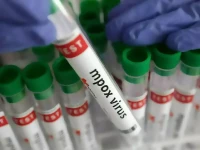another mpox case reported in city