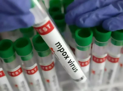 another mpox case reported in city
