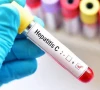 pakistan tops world in hepatitis c pakistan tops world in hepatitis c