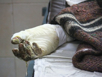 worker jumped to land on a pile of unconscious bodies