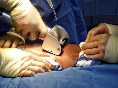 mayo hospital rs2 million equipment theft raises concern