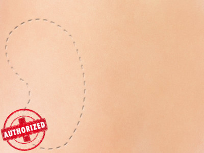 transplantation regularity authority govt issues ordinance to curb illegal organ donation