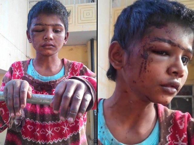 pictures of her bruised face and hands went viral and hash tags such as justicefor tayyaba started making rounds on twitter and facebook