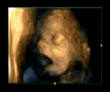 4d scans show fetuses yawn in the womb