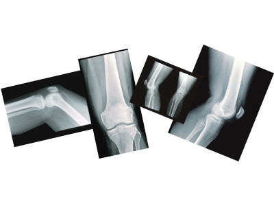 healthy living bend it like beckham