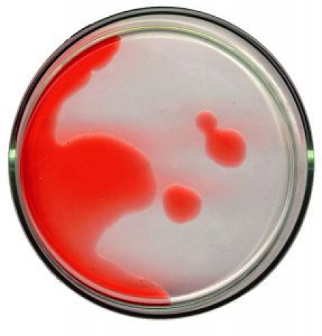 symposium on molecular medicine begins on monday symposium on molecular medicine begins on monday