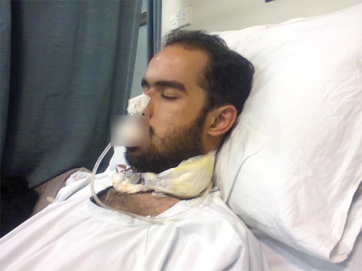 lyari mystery surviving twin makes it out of surgery after attack