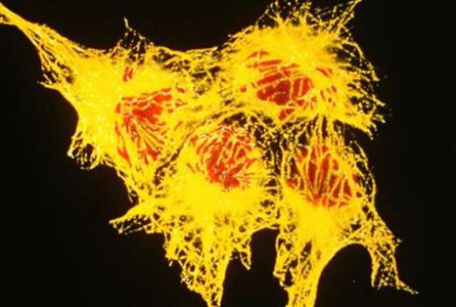 there were 20 million hepatitis c patients in the country 25 000 of the total were getting treatment photo reuters file there were 20 million hepatitis c patients in the country 25 000 of the total were getting treatment photo reuters file