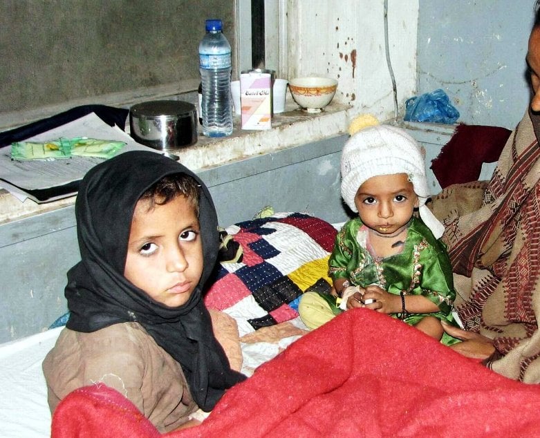 family members hold their children suffering from measles admitted at a local hospital in hyderabad photo ppi file