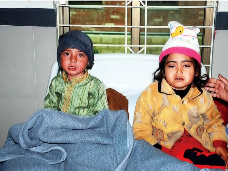 children suffering from measles being treated at hospital in hazroo photo online