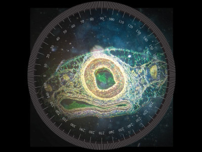 aids they call him patient zero aids they call him patient zero