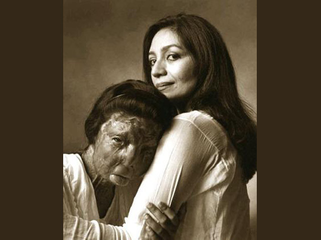 fakhra younus who had been allegedly attacked with acid nearly 12 years ago photo guido harari file