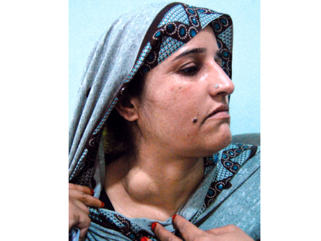 the 30 year old kashmiri woman has been denied for the third time by doctors at polyclinic photo the express tribune the 30 year old kashmiri woman has been denied for the third time by doctors at polyclinic photo the express tribune