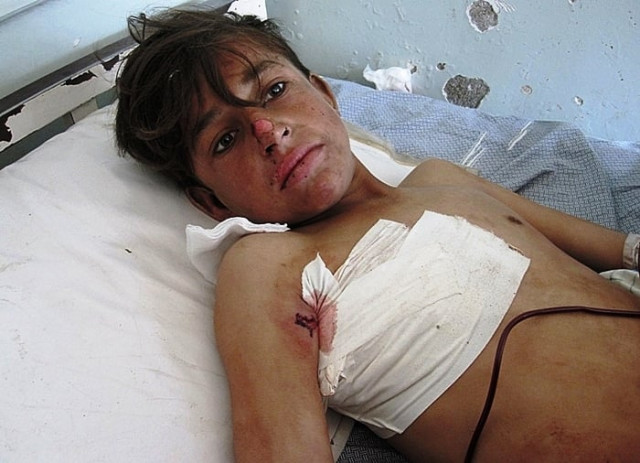 a wounded afghan boy receives treatment at a hospital in kunar province following a nato airstrike photo afp file a wounded afghan boy receives treatment at a hospital in kunar province following a nato airstrike photo afp file