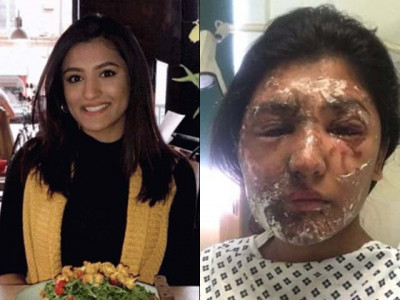 are acid attacks becoming a commonality in the uk because they are treated as a minor offence