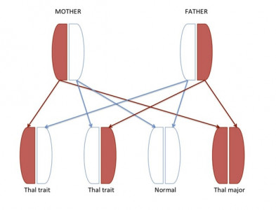 6 000 children born with thalassaemia in pakistan yearly