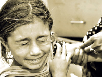 endemic measles outbreak reported in mansehra