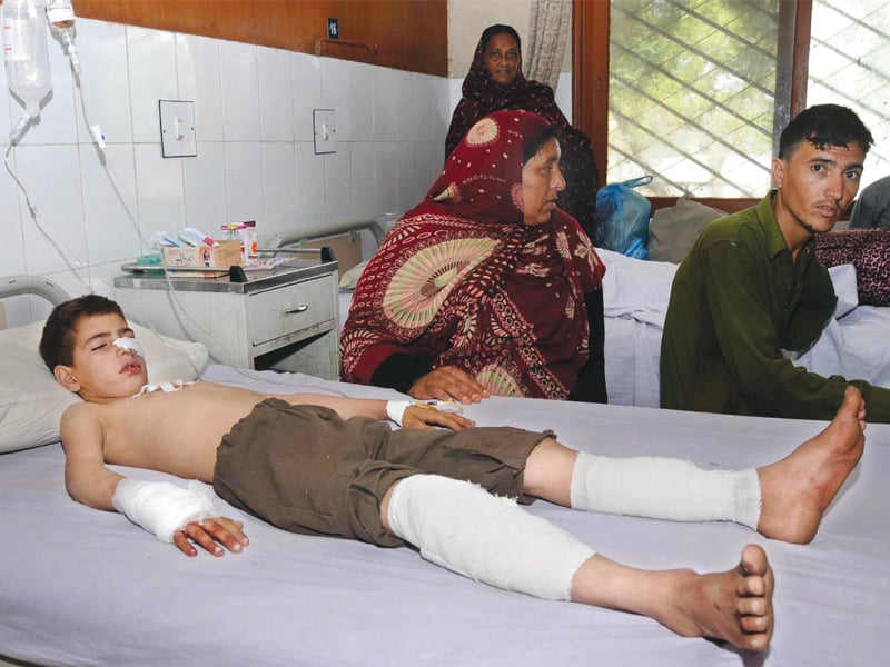 izhar ahmed 10 was injured when a ball packed with explosives was thrown at government boys primary school baitul firdous in orangi town on friday photo rashid ajmeri express