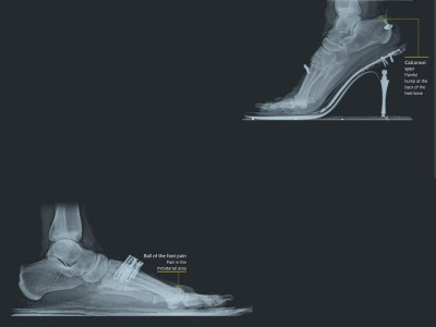 killer shoes killer shoes