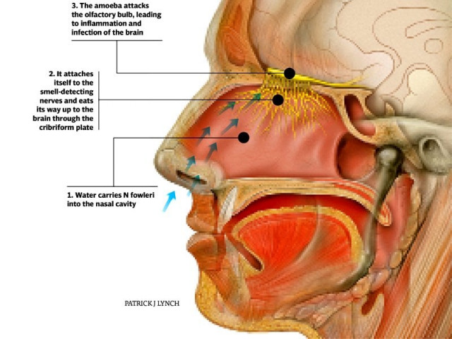 karachi s water has small quantities of the brain eating amoeba here s how to do wuzu safely karachi s water has small quantities of the brain eating amoeba here s how to do wuzu safely