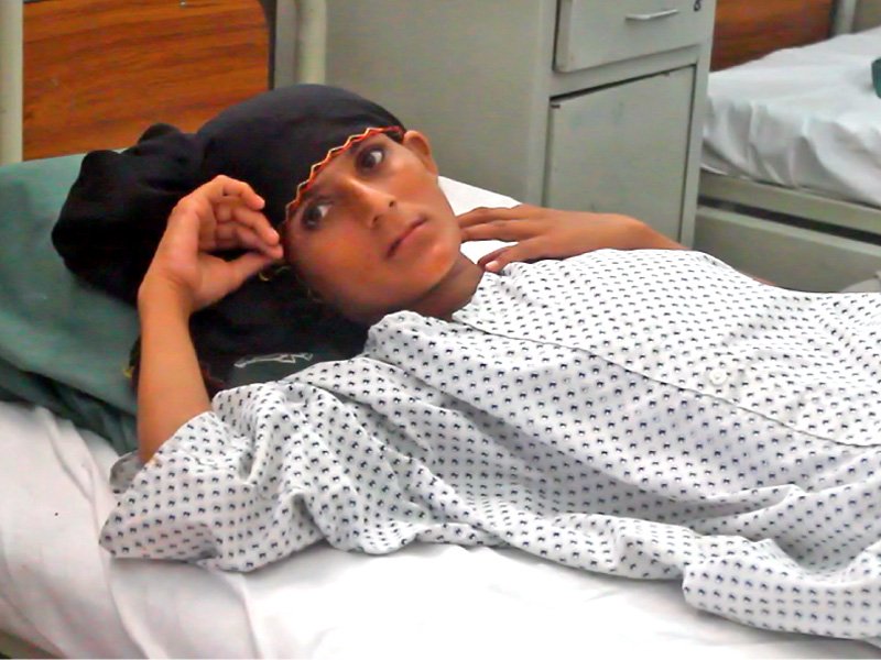 only 30 surgeons in pakistan can treat the condition photo sarah munir